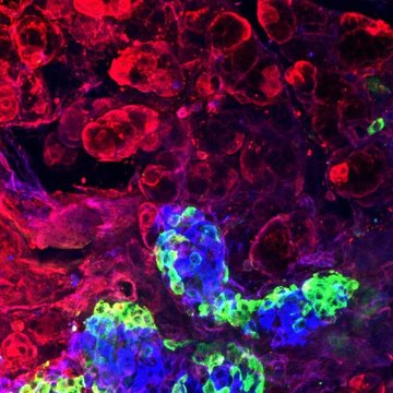 Endocrine pancreas development at single cell level