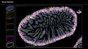 New opportunities for studying spatial proteomics at the BIOCEV Centre