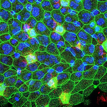 Newly Discovered Regenerative Cells May Revolutionize Wound Healing