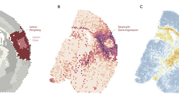 Groundbreaking study maps brain’s recovery process after stroke using spatial transcriptomics